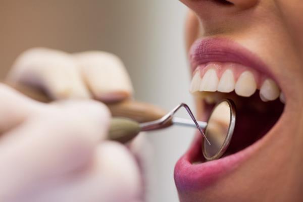 Esta modificación del color de los dientes debe ser supervisada por un odontólogo